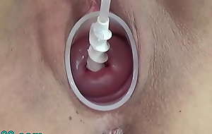 Milf Cervix Insertion with spiral catheter be worthwhile for insemination and dildo Jav Way-out